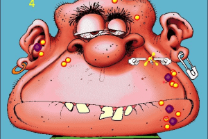 Acne Attack