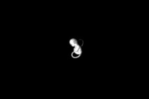 Embryo