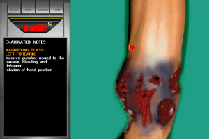 Emergency Room